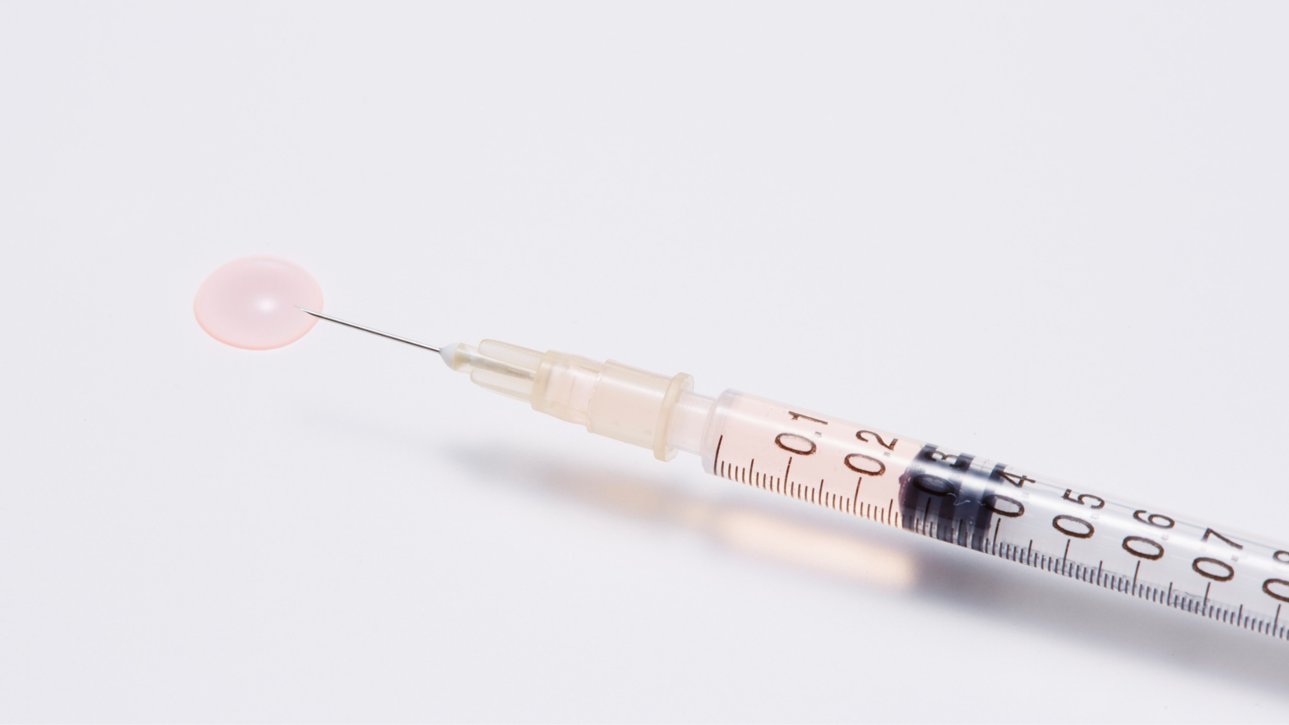 Exosomes and Edges: Can Exosome Reverse Traction Alopecia?