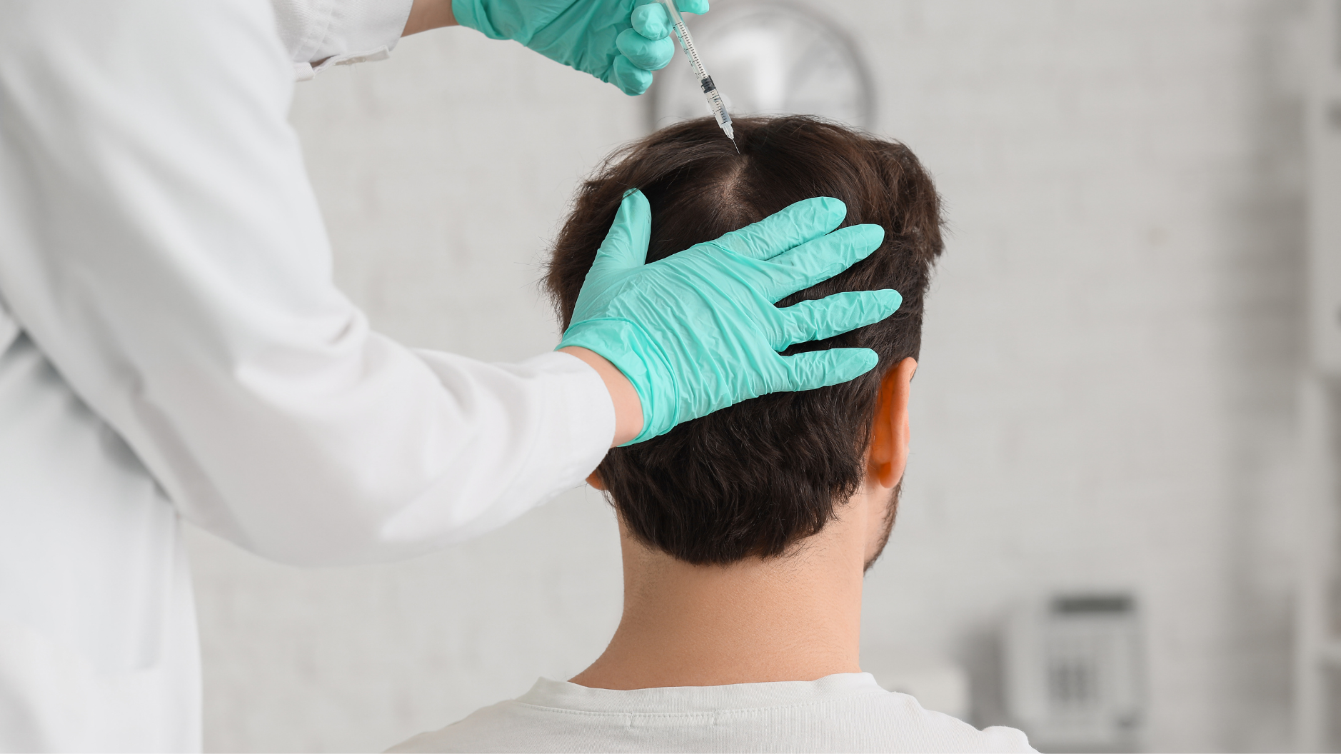 Mesotherapy for Androgenetic Alopecia: Does It Really Work?
